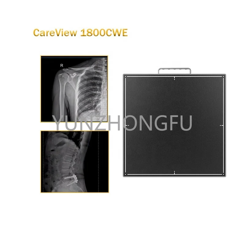 CareView 1800CWE Висококачествен Дигитален Рентгенов детектор DR Wireless FPD Flat Panel Detector - 1