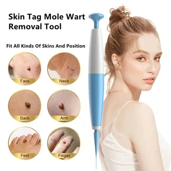 1Set Skin Tag Remove Инструмент За Почистване на Микро-Кожа От Бенки И Брадавици, Определени За Премахване на Кожни Етикети С Почистване на Тампони Комплект За Грижа За Лицето От Бенки и Брадавици За Възрастни